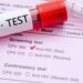 HIV testing